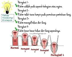 Sekolah teknik di malaysia / senarai 402 sekolah '. Dayang Dropship Bumil Publications Facebook