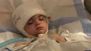 A volta à escola de Joseph, o menino que sofreu um aneurisma aos 3 anos e  perdeu 40% do crânio