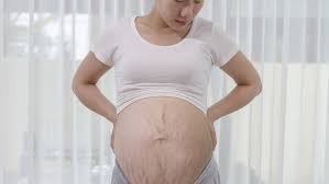 Pada fase hamil 3 bulan, ibu perlu menjaga kesehatan ibu dan bayi agar perkembangannya tetap berjalan dengan baik. Ini Bedanya Stretch Mark Merah Dan Putih Saat Hamil