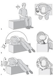 The home epley maneuver is a type of exercise help that helps to treat the symptoms of benign paroxysmal positional vertigo (bppv). Https Dgn Org Wp Content Uploads 2013 01 Ll08kap 052 Pdf