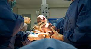 Bersalin secara normal selepas beberapa kali menjalani pembedahan caesarean bukanlah sesuatu yang mustahil, namun anda perlu terdapat juga bukti bahawa risiko pecah rahim selepas dua kali atau lebih caesarean adalah kecil juga. Penerangan Risiko Melahirkan Anak Melalui Pembedahan Caesarean Oleh Doktor Izzat Iluminasi