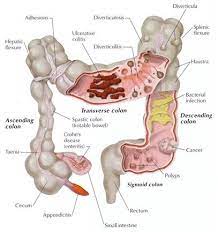 We did not find results for: Shankha Prakshalana A Deep Colon Cleansing Technique Gerard Ribo