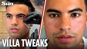 Love Island's Harrison, 22, reveals pre-villa glow up as he gets tweakments  with celebrity doctor