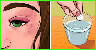 What do you think about these seven home remedies for itchy skin? 15 Home Remedies To Treat Dry Skin Around The Eyes