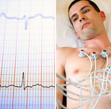 An ekg is a paper or digital recording of the electrical signals in the heart. Medizintechnik Mehrzahl Der Infarkte Wird Vom Ekg Nicht Erkannt Welt