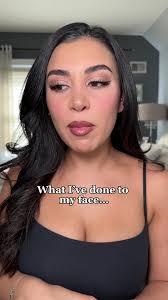 my experience with veneers 🦷 Instagram: @drmarynashed @southavenue.dental  #veneers #smiletransformation