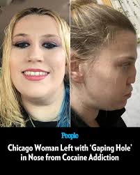 🔗: bit.ly/41xs6J5 Kelly Kozyra, who has been sober since 2021, recalls  shoving her pinky in her nose "to hold all the cocaine up there so I didn't  lose it." 📷: Kennedy News