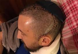 Uncovering Hidden Blessings: My Brush with Death