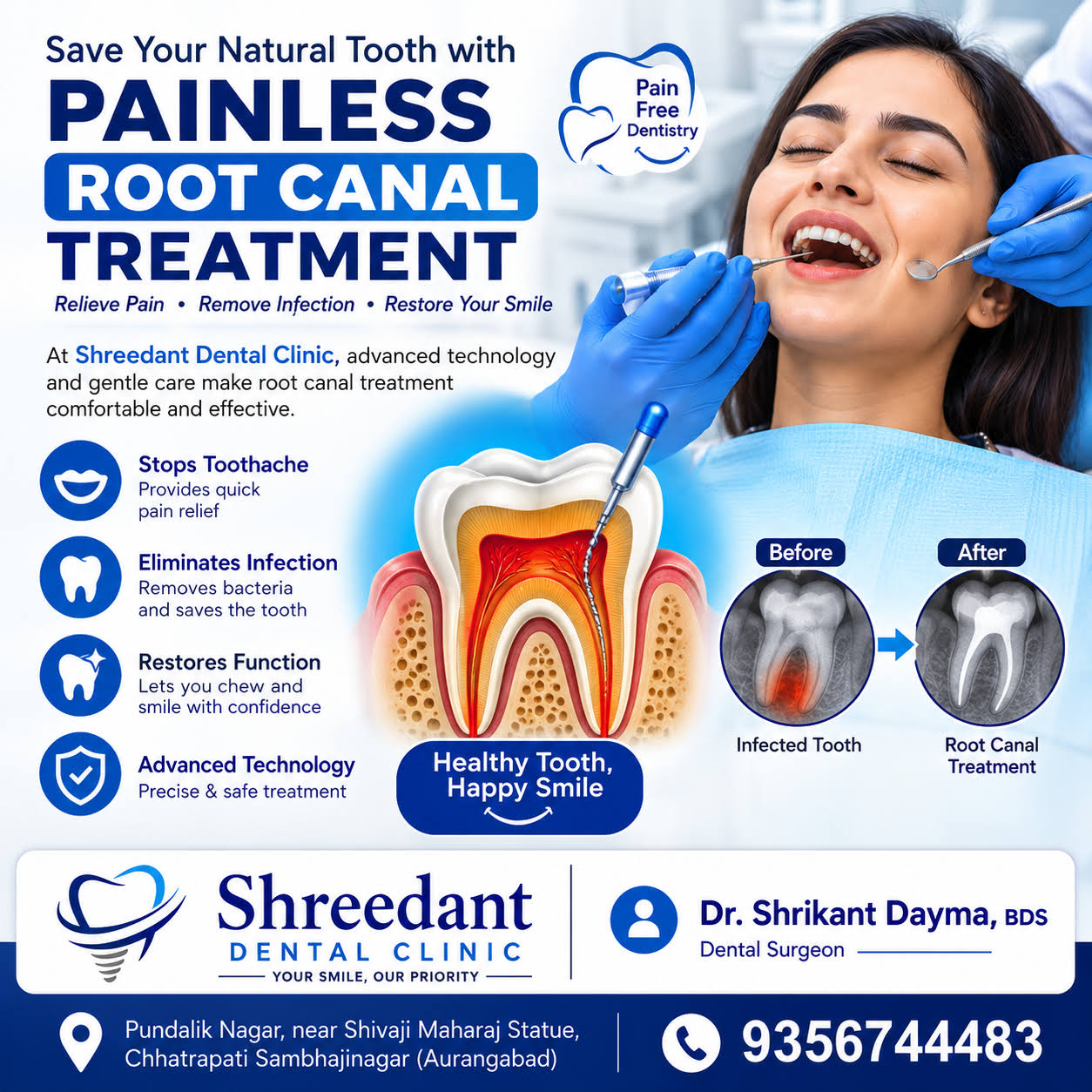 Root canal Treatment product image