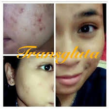 Selepas anda mencuci muka dengan bersih ambil sebiji tomato dan dibelah. Transgluta By Zenia Rahsia Memutihkan Kulit Satu Badan Ayue Idris