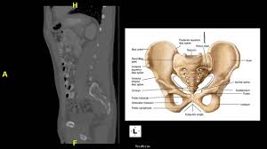 Maybe you would like to learn more about one of these? Pelvic Muscle Ct Anatomy Anatomy Drawing Diagram