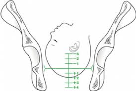 the concept of conventional fetal station delees station