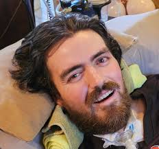 Living with ALS and its progression