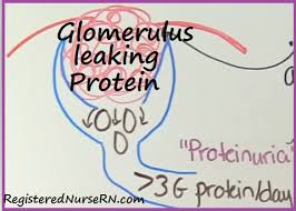 Because proteinuria and albuminuria have numerous possible causes, they must be assessed appropriately to determine their implications for the patient. Nephrotic Syndrome Nclex Review