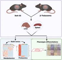 Metabolic and Proteomic Divergence is Present in Spleens and Livers from  Berkeley Sickle Cell Anemia and β‑Thalassemia Mice