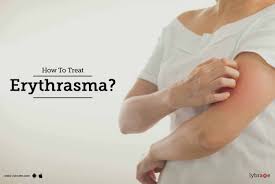 Image result for Erythrasma