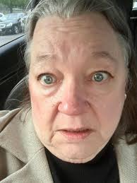 Non-athletic woman hit by foul ball at grandson's game