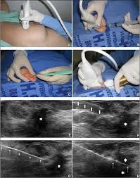 Pin On Abd 300 Mod 4 Ultrasound