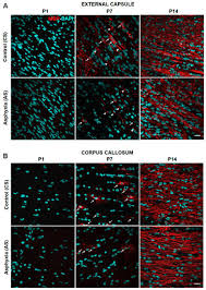 Check spelling or type a new query. Ijms March 2 2021 Browse Articles