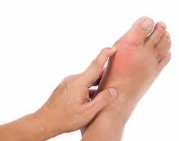 Podagra Lechenie Simptomy Diagnostika Profilaktika V Spb
