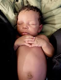 The struggles of being a baby with itchy body parts