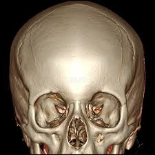 Image result for CT Head