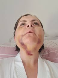 Recovery from surgery and well wishes