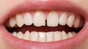 Check spelling or type a new query. Bonding Santa Clarita Ca