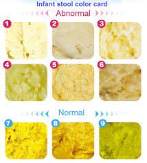 Seminggu baby areefa kene cirit….kesian ibu tgk….hari first kene cirit terus bw p klinik…so dic kt maybe masalah air.or tersalah. Stool Color Chart Graces For Baby Meg