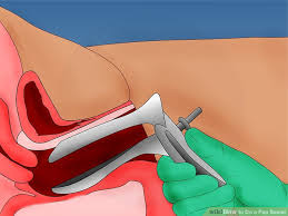 Selama proses pap smear, dokter akan meminta apakah pemeriksaan pap smear terasa sakit? Ujian Pap Smear Apa Yang U N I Klinik Mata Ayer Perlis Facebook