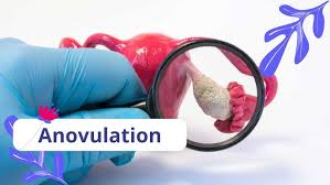 Image result for Anovulation
