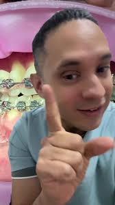 Sondaje periodontal en ortodoncia: ¿Por qué es esencial?