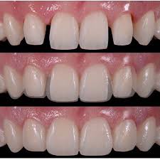 Get the fastest access to the best doctors. 788 Likes 4 Comments Instagram Dentists Gallery Styleitaliandentistry On Instagram Dranuriaoteroficial Cosmetic Dentistry Dentistry Dental