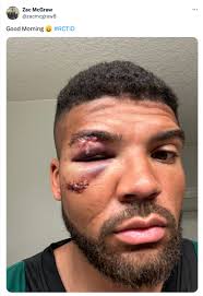 In Zac McGraw, the Portland Timbers may have found their red zone receiver