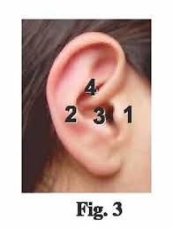 How To Size Docs Proplugs Ear Plugs B T E Hear Aid