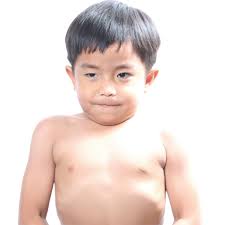 Admin kesehatan reproduksi 36 comments. 6 Tanda Anak Kurus Sehat