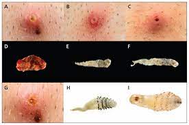 Myasis indah widyaningsih, bambang supriyono lect le ctur urer er facul faculty ty of medic medicine ine,, univer universit sity y of wija wijaya ya kusuma kusuma sur suraba abaya ya. Imported And Locally Acquired Human Myiasis In Canada A Report Of Two Cases Cmaj
