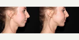 Fargo Center for Dermatology