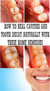 How do you remove trees from a home on yoville? How To Heal A Cavity Without Fillings Replyhowto