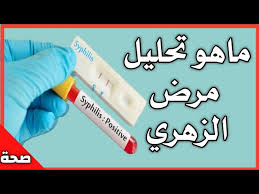Access a wealth of content produced by our network of outstanding journalists worldwide, including news as it breaks and stories from our vast multimedia archive. Ù…Ø§Ù‡Ùˆ Ù…Ø±Ø¶ Ø§Ù„Ø²Ù‡Ø±ÙŠ Syphilis æ—¥æœ¬ Ù…Ø±Ø¶ Ø§Ù„Ø²Ù‡Ø±ÙŠ Ø§Ø³Ø¨Ø§Ø¨Ù‡ ÙˆØ§Ø¹Ø±Ø§Ø¶Ù‡ ÙˆØ¹Ù„Ø§Ø¬Ù‡ By Ù…Ø­ÙˆØ± Ø§Ù„Ø¬Ø³Ù… Body Hub