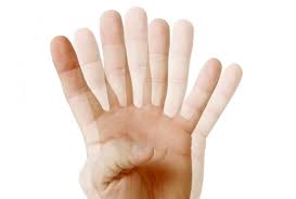 فأجابه أبو جعفر بلا فكرة ولا روية : Glaucoma Types Causes And Symptoms