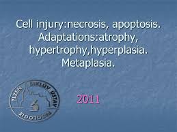 Sepsis may progress to septic shock. Cell Injury Necrosis Apoptosis Ppt Video Online Download