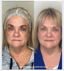 NW Beauty & Wellness‎