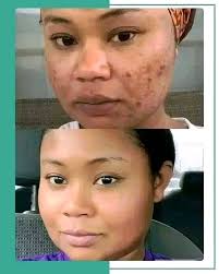 Should I edit raw photos in Darktable or GIMP first for removal  spot/healing?