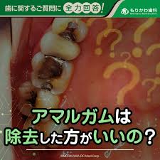 アマルガムは除去した方がいいのかについて徹底解説