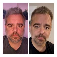 58 days nicotine free and 25 days sober from alcohol ❤️‍🩹