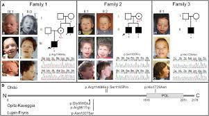 Mutations In Med12 Cause X Linked Ohdo Syndrome Sciencedirect