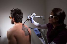 Some tattoos require up to eight laser sessions. 8 Easiest Remedies To Remove Skin Tattoo Pouted Com