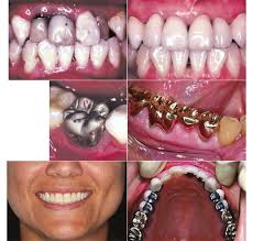 Contemporary Fixed Prosthodontics