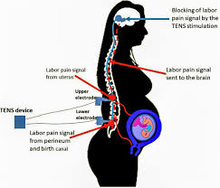 Image result for Labor Sedation